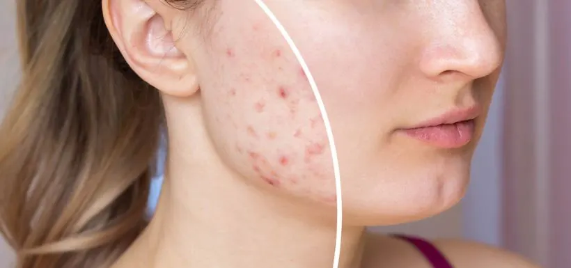 Nutrition & Amincissement — Dr Raddad, dermatologue Ain Chock Casablanca